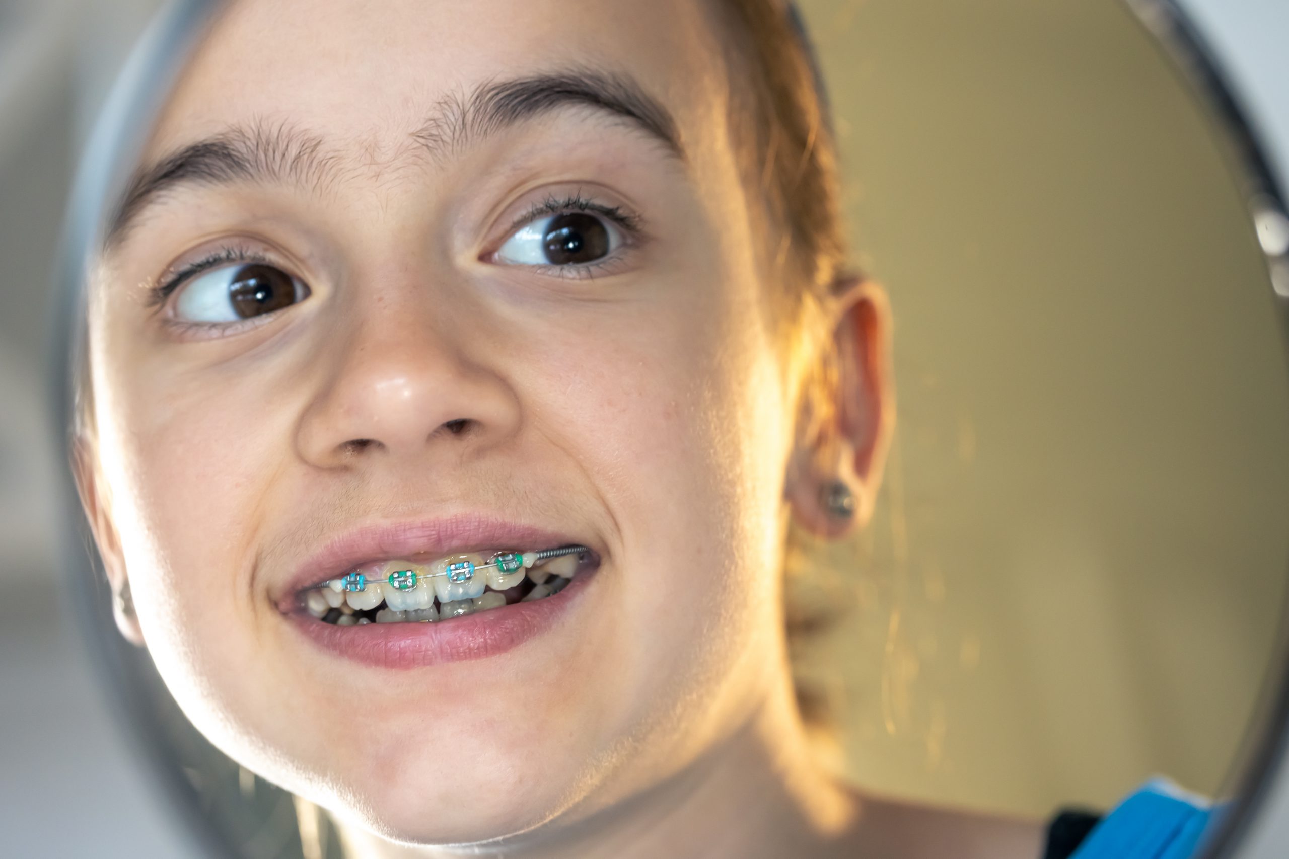Caucasian preteen girl with braces on her teeth looking at the mirror, perfect smile concept.